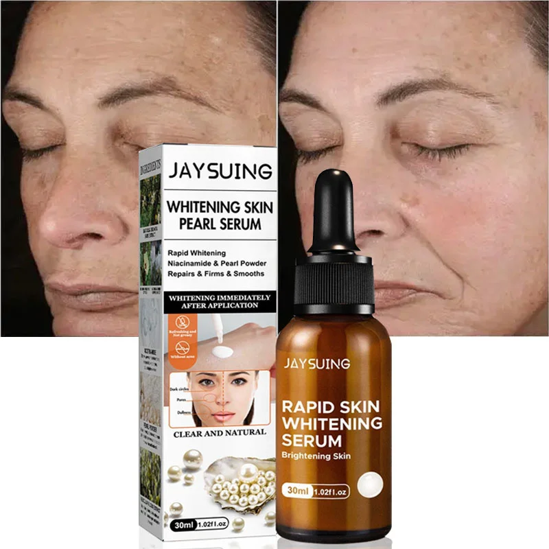 

Nicotinamide Whitening Freckle Serum Fade Dark Spots Remove Melasma Melanin Face Essence Brighten Pigment Correction Products