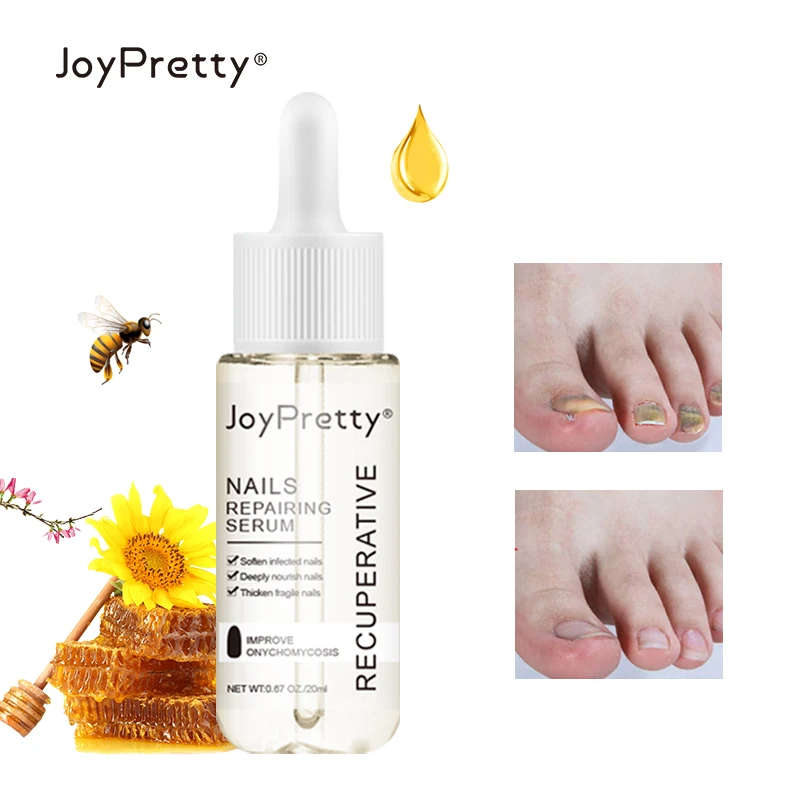 Сыворотка для лечения грибка ногтей 20 мл |