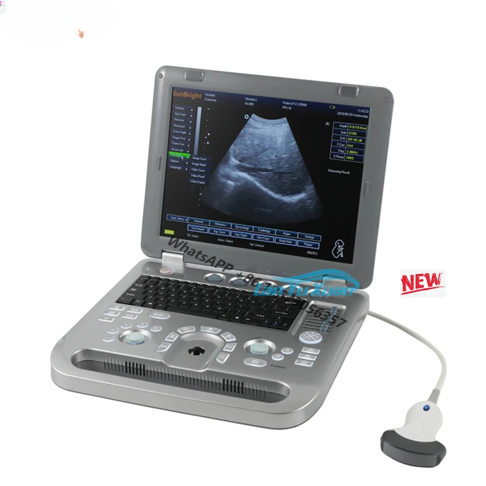

High Quality Full Digital Ultrasound Diagnostic System Notebook Portable Ultrasound Scanner 3D Ultrasound Machine