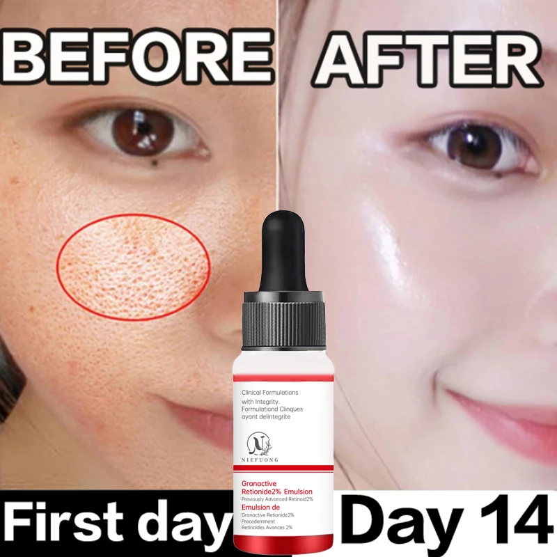 

Pore Minimizer Serum For Face Pore Facial Pore Narrowing Serum Pore Contraction Tightens Essence Shrink Pores Serum