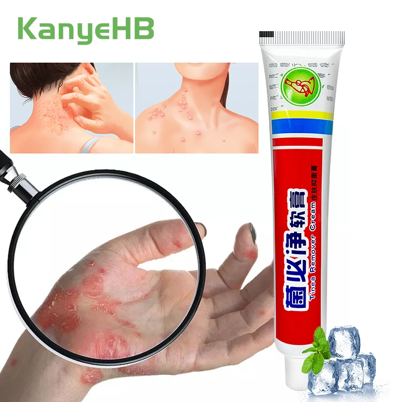 

1Pcs Psoriasis Cream Treatment Dermatitis Eczematoid Eczema Beriberi Herb Ointment Relieve Skin Itching Antibacterial Cream S081