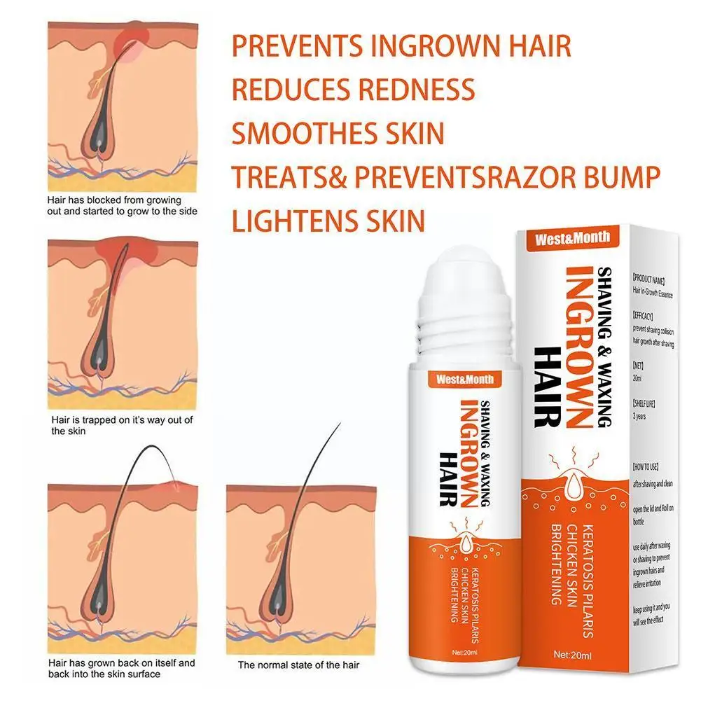 20ml Ingrown Hair Cream Bump Removal Stopper Treatment Serum Redness Prevent Waxing Repairing After Shaving Reduce Skin E8Q9 - купить по