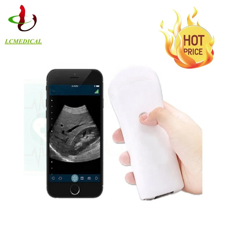 

2021 new style medical wireless ultrasound probe with wholesale price