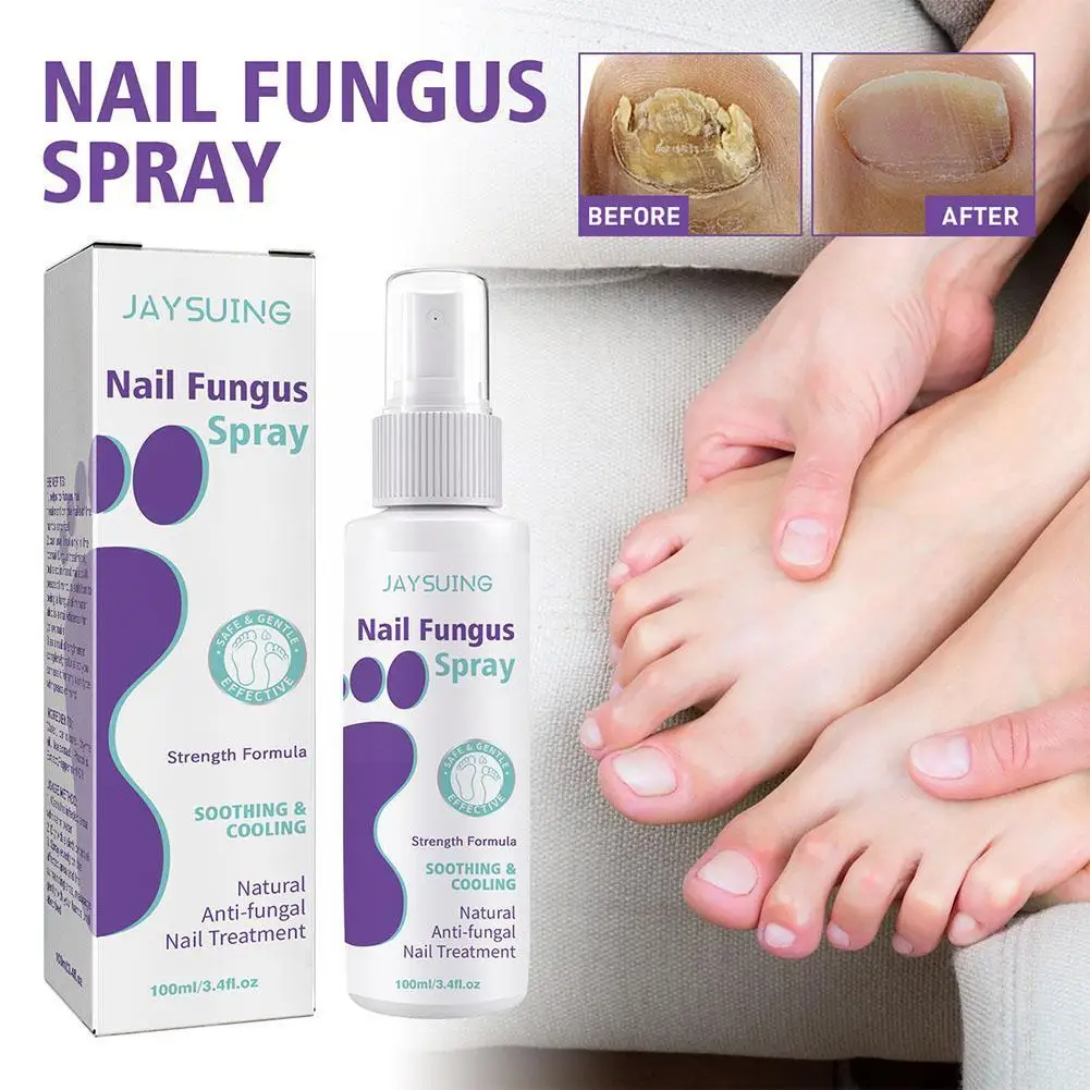 

100ml Effective Fungal Nail Treatment Serum Anti-Fungal Repair Foot Care Foot Repair Essence Restore Fungus Shine Spray Nai R6P8