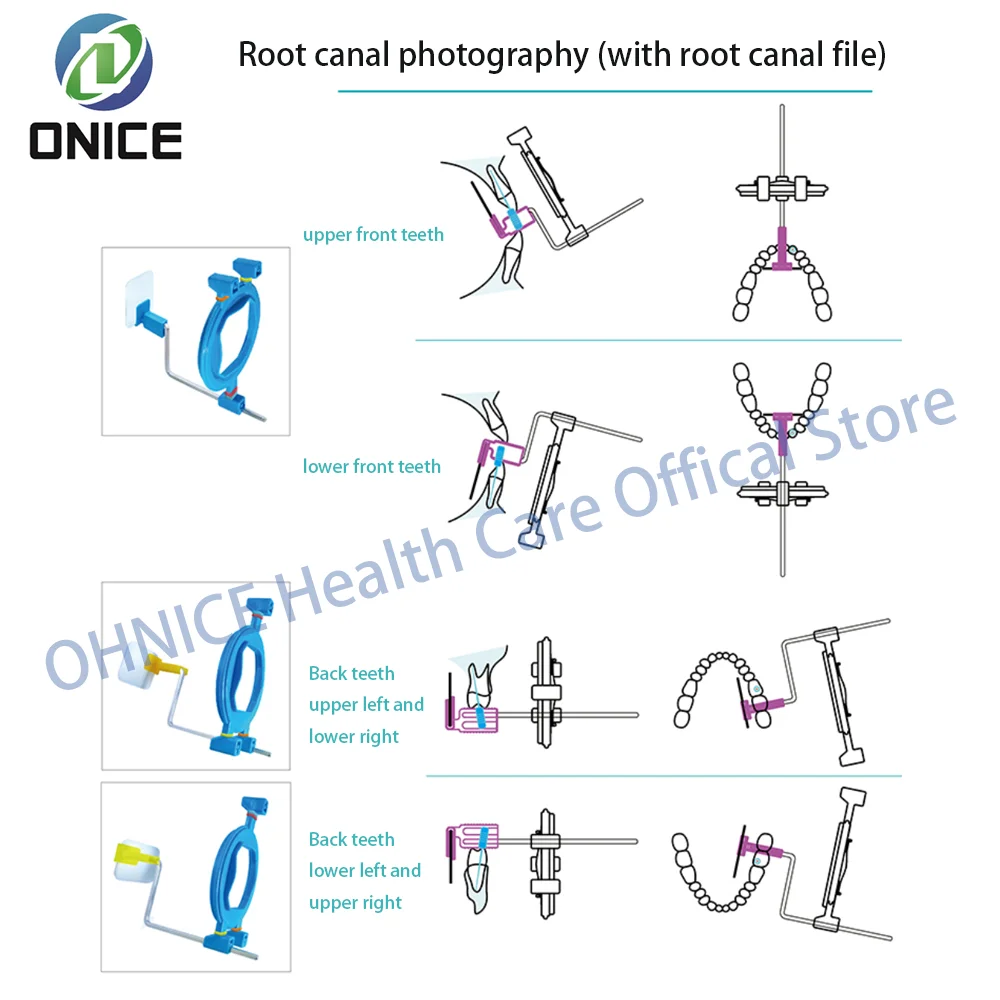 Стоматологический держатель для рентгеновской пленки стоматологический