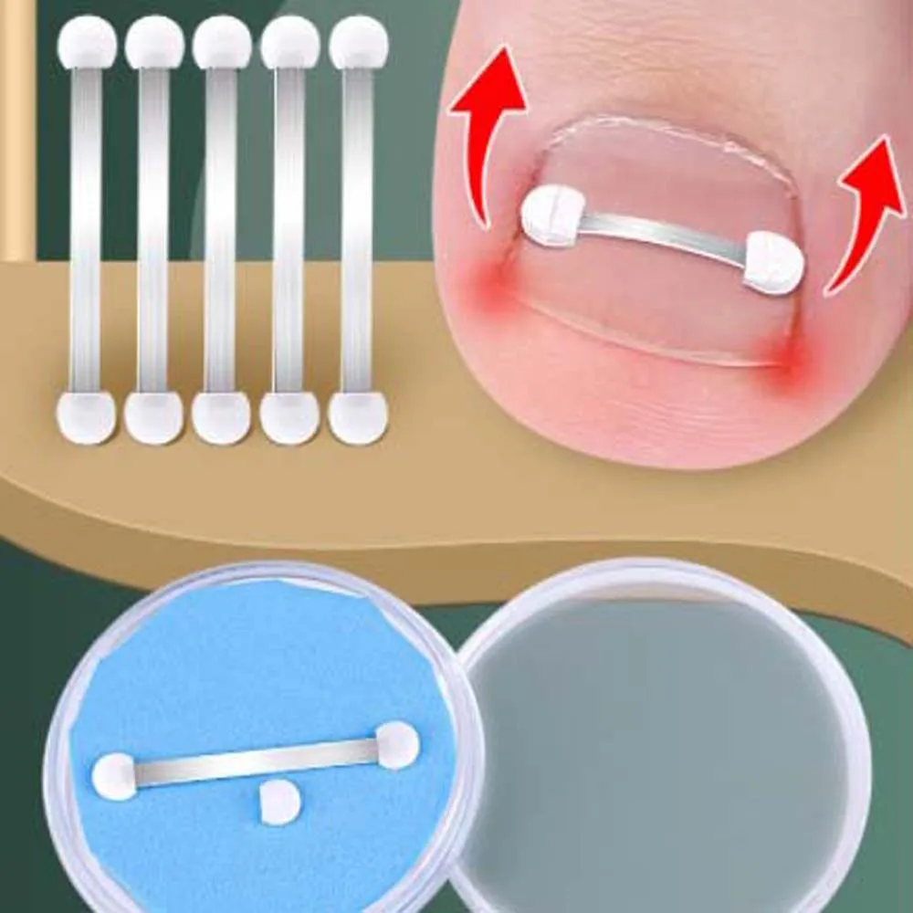

1 Pc Ingrown Toe Nail Fixer Embed Toenail Correction Lifter Pedicure Tool Foot Feet Care Pedicure Recover