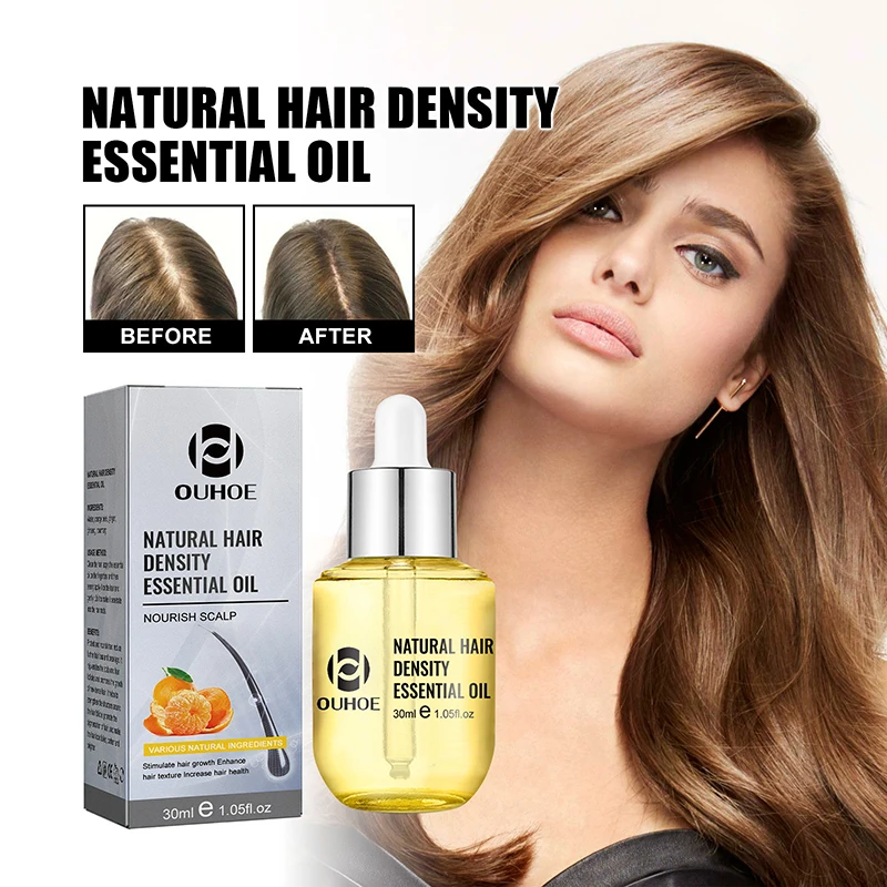 

30ml Hair Essential Oil Moisturizes And Thickens Hair And Repairs Hair Root Damaged Hair And Strengthens Hair Care Essential Oil