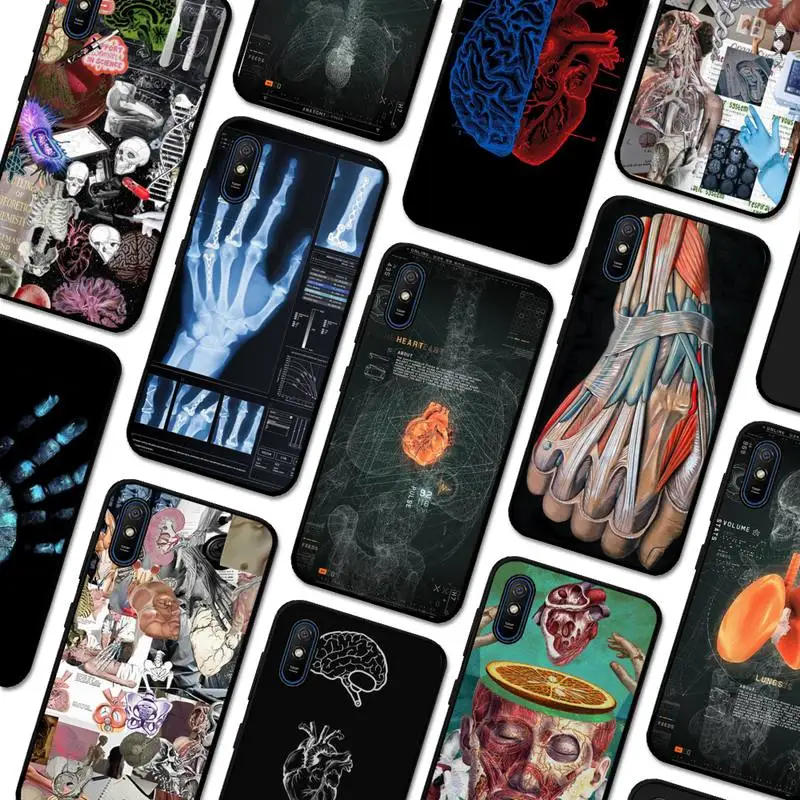 

Radiological human organs Skeleton skull Phone Case For Redmi 5 6 7 8 9 10 plus pro 6 7 8 9 A GO K20 K30 K40 pro plus F3 Fundas