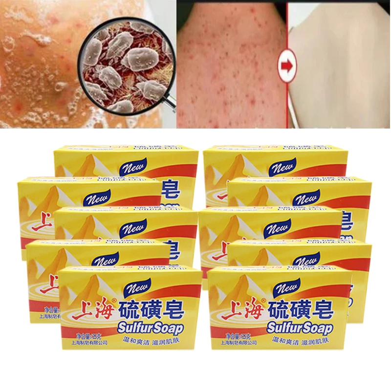 

10Pcs Shanghai Sulfur Soap Oil-Control Acne Treatment Psoriasis Seborrhea Eczema Anti Fungus Bath Healthy Soaps Eczema Wholesale