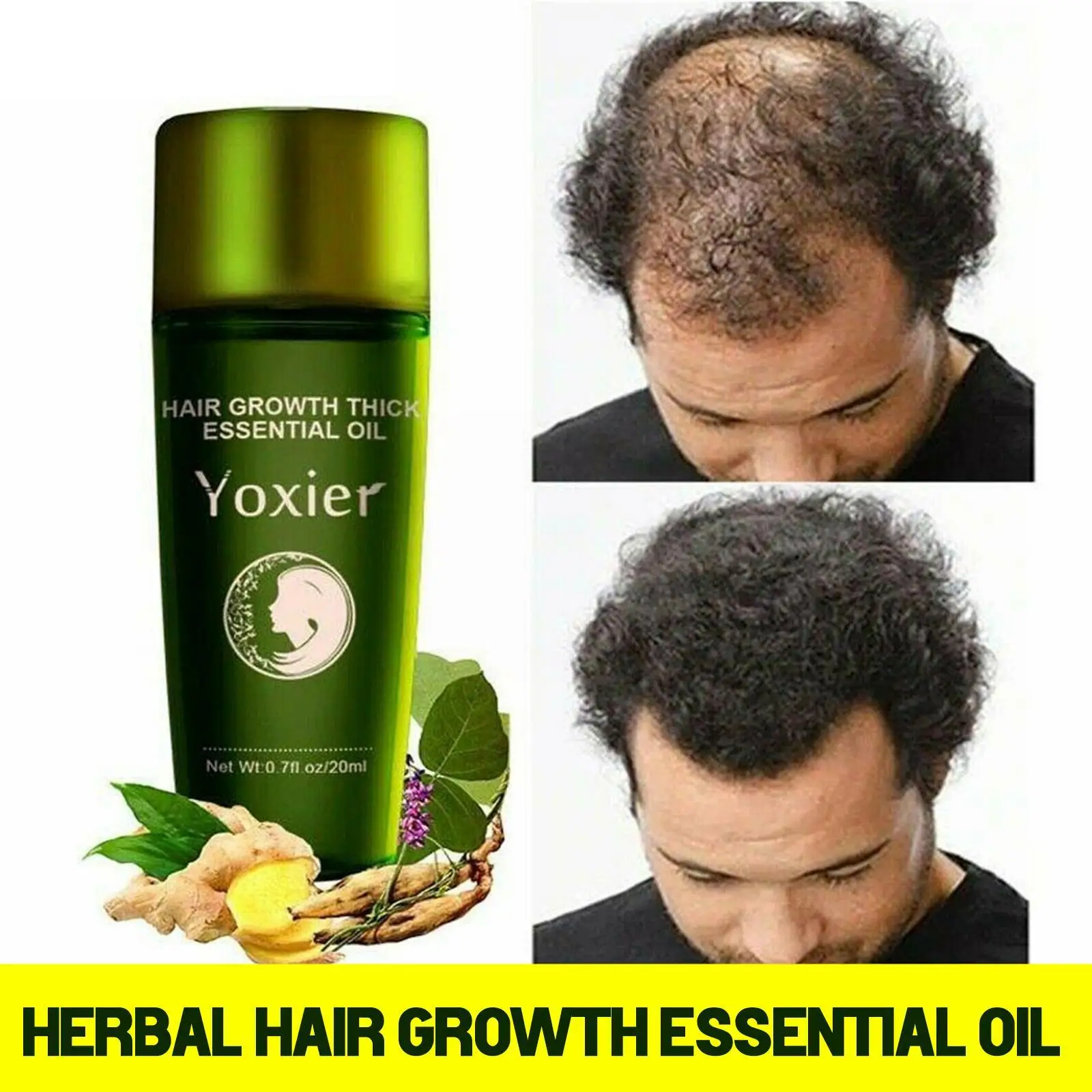 

Effective Herbal Hair Growth Essential Oil Fast Growth Treatment Hair Growth Dense Hair Hair Care Serum Repair Care Serum L1A7