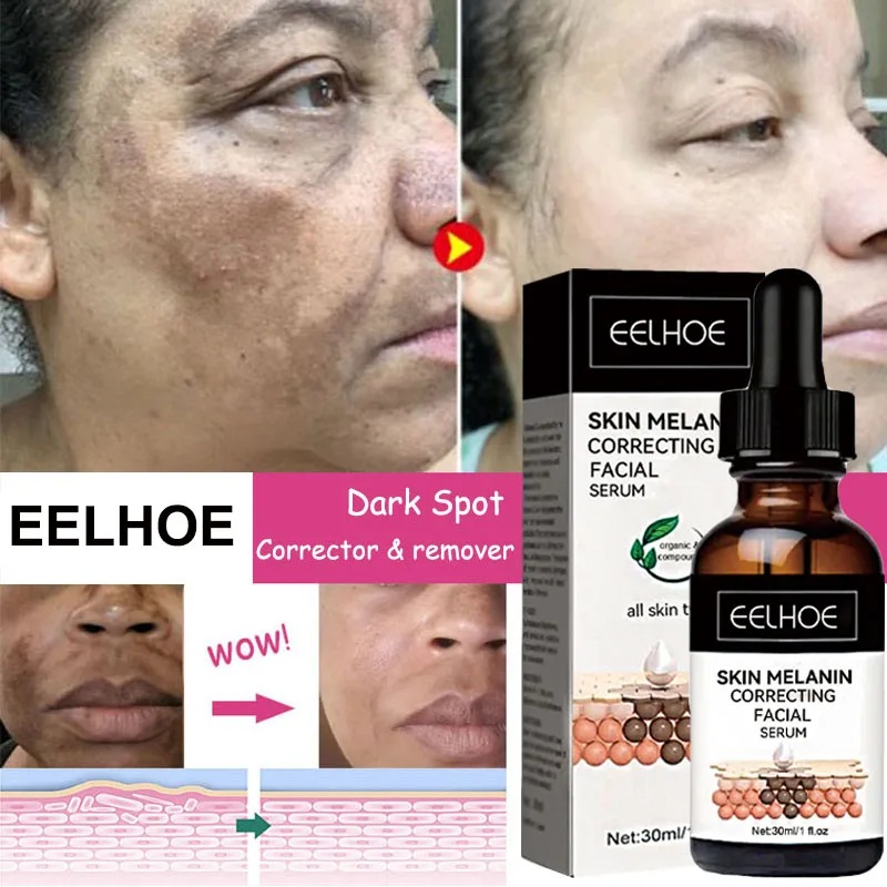 

Whitening Freckle Serum Fade Melasma Dark Spots Remove Pigment Melanin Corrector Brighten Beauty Skin Care Korea Comestics 30ml