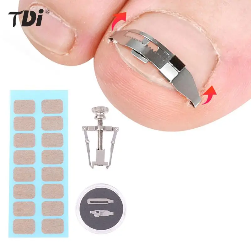 

Ingrown Toenail Corrector Tools Pedicure Recover Embed Toe Nail Treatment Professional Foot Care Correction Tool Care Foot