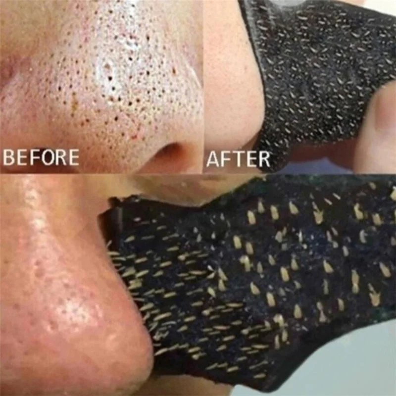 10 PCS Nose Blackhead Remover Mask Deep Cleansing Skin Care Shrink Pore Acne Treatment Black dots Clean Strips |