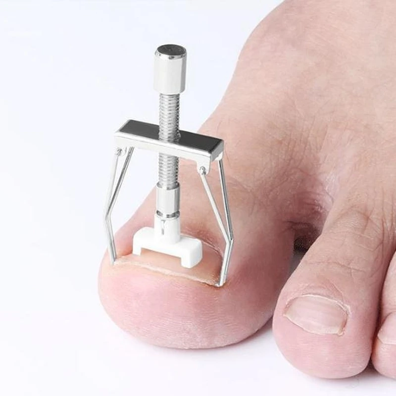 

New Ingrown Toe Nail Recover Correction Tool Pedicure Toenail Fixer Foot Nail Care Tool Orthotic Nail Corrector Pedicure Tool