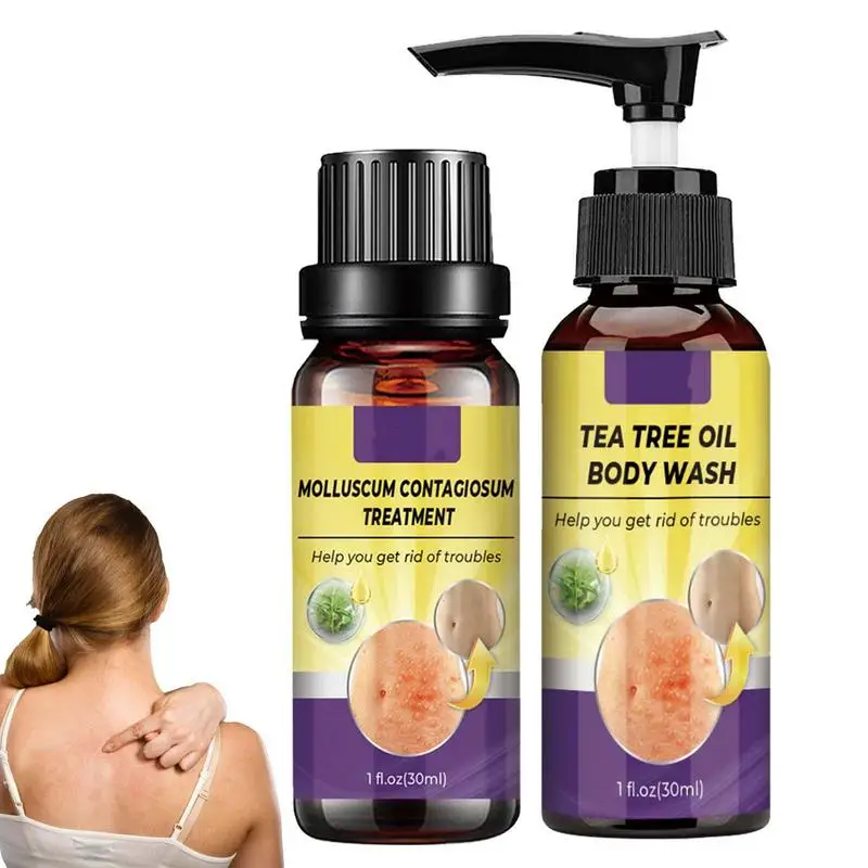 

Wart Remover Molluscum Contagiosum Kit For Molluscum Contagiosum Repair Molluscum Contagiosum Solution & Tea Tree Oil Body Wash