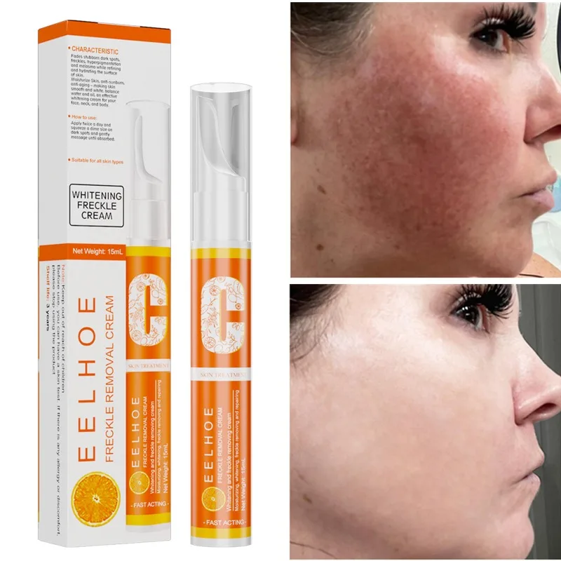 

Fade Spots Remove Blemishes Freckle Pen Rejuvenating Moisturizing Skin Brightening Cream Firming Skin Improve Dullness VC Cream