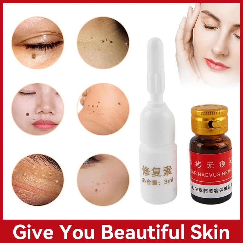 

Раствор для удаления родинок и кожи, безболезненное удаление участков кожи, бородавок на лице, крем для удаления веснушек, масляный пластырь