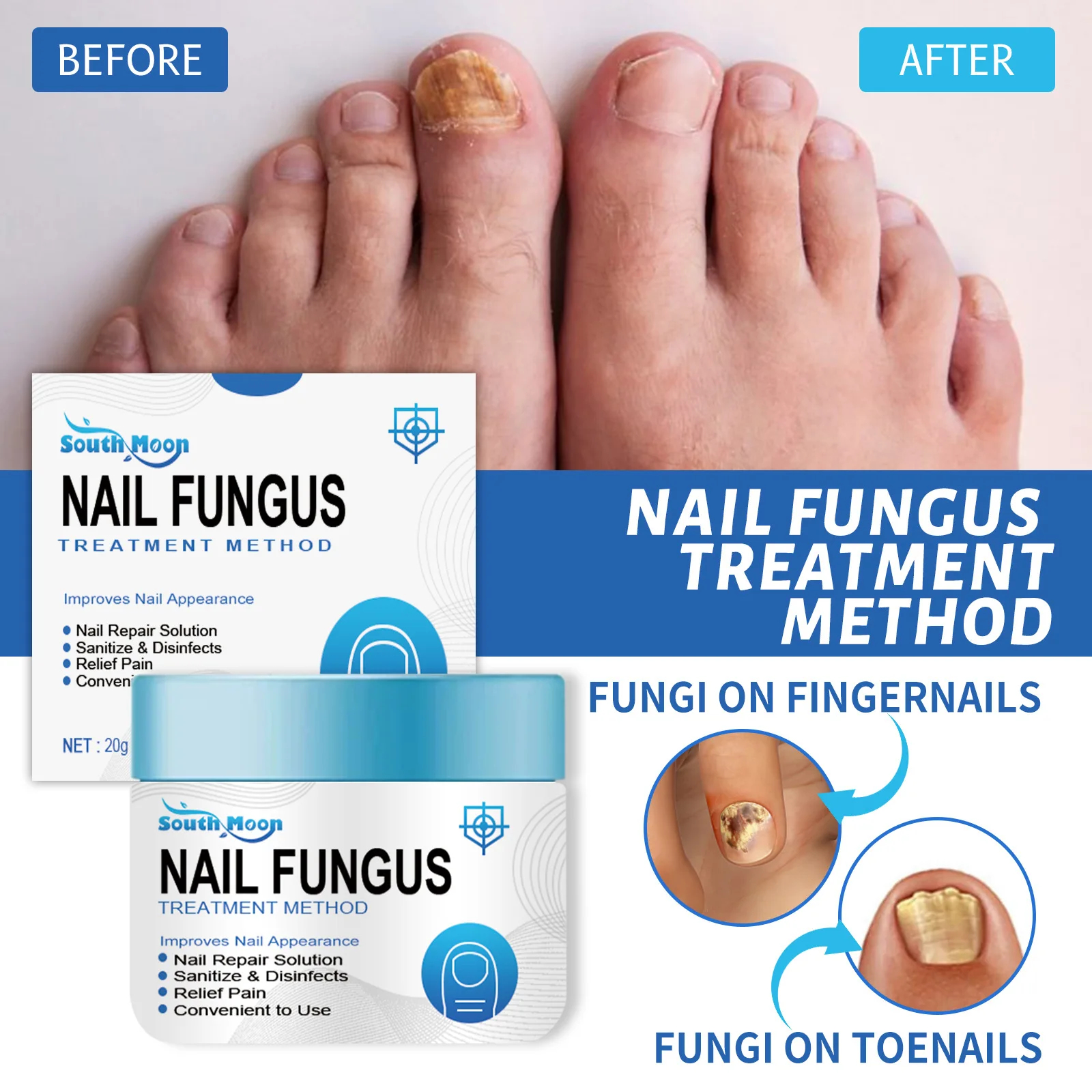 

Nail Fungus Treatment Ointment Remedy For Removes Extra Strong Effective Cream Repair Anti Best Foot Against