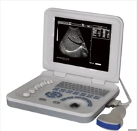 portable black and white ultrasound best price china medical ultrasound scanner portable ultrasound price