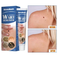 skin tag remover cream warts remove ointment wart treatment neck armpit flat genitals corn warts antibacterial body cream 1pcs