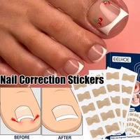 50pc nail ingrown correction sticker foot care pedicure tool waterproof fixer paronychia recover toenail elastic patch corrector