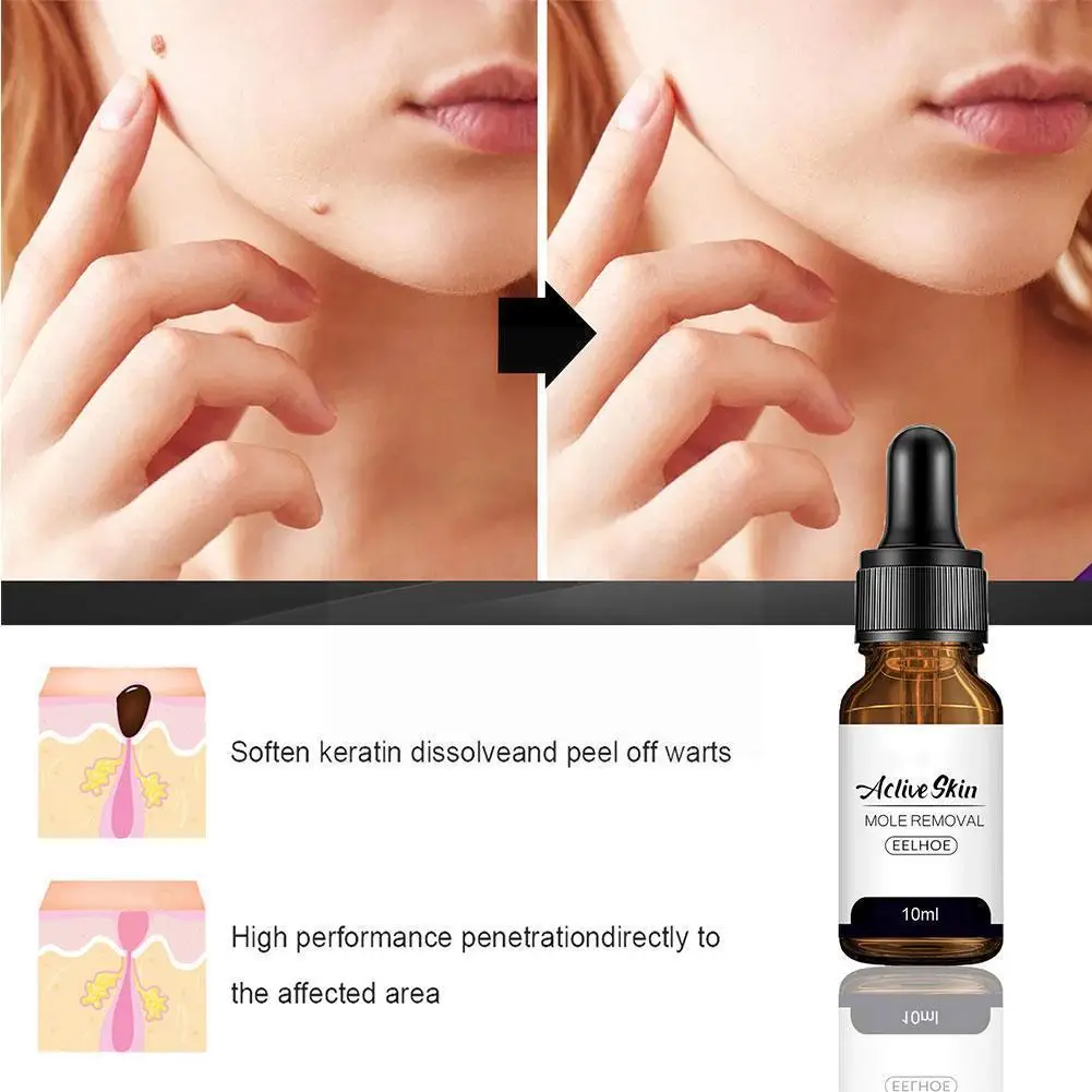 

10ml Wart And Mole Removal Sence Skin Wart Skin Tag Removal Papillomas Genital Wart Removal Liquid Skin Treatment Care W3f5