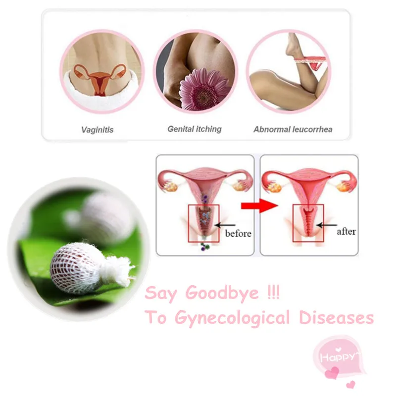 

Жемчужины Yoni, бриллиантовый тампон для женщин, китайская медицина, лечение фиброзы, красивые точки жизни, тампоны, гинекологические проклад...