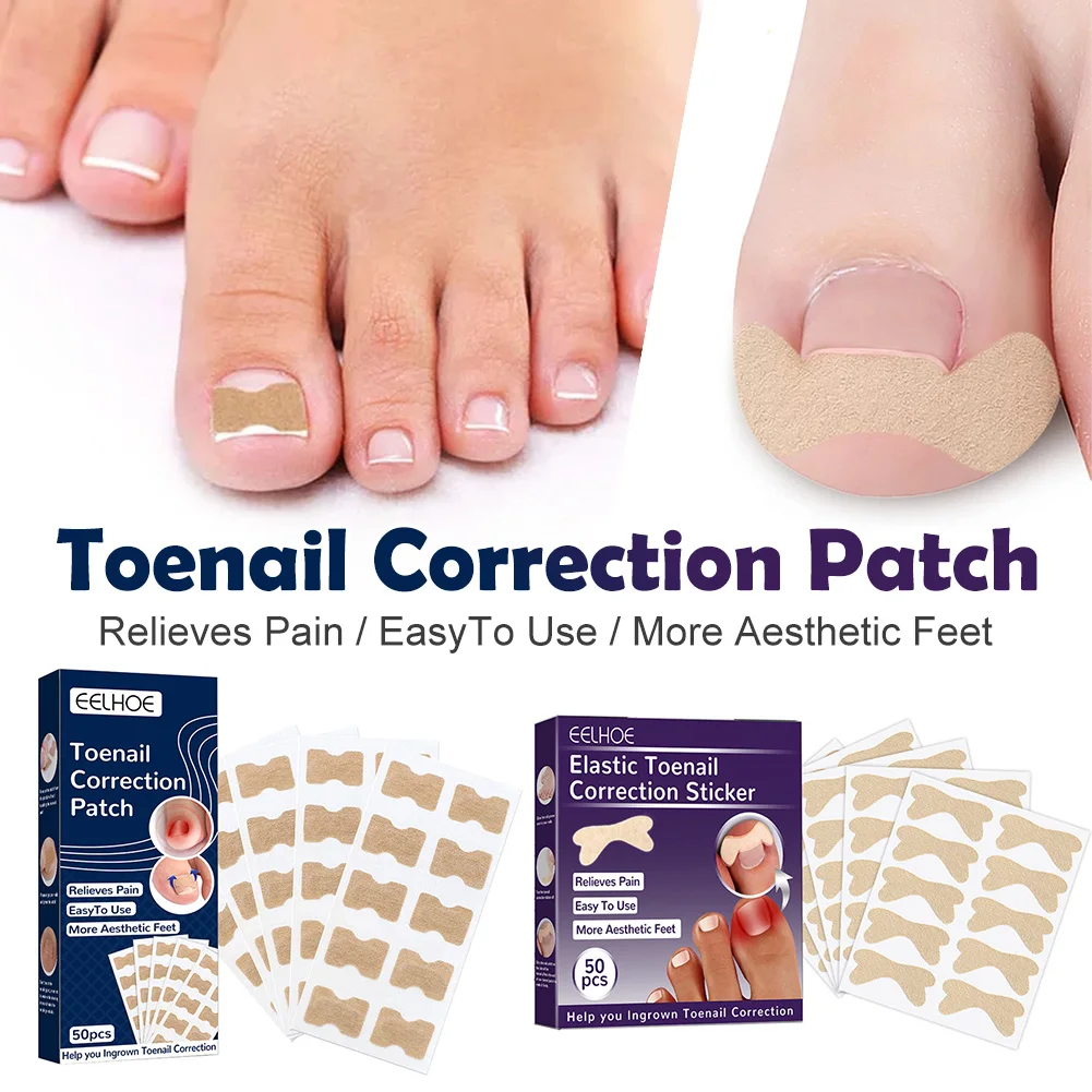 

50pcs Nail Correction Stickers Ingrown Toenail Corrector Patches Waterproof Paronychia Treatment Recover Corrector Pedicure Tool