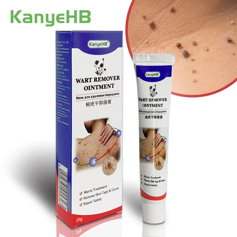 

Wart Remover Cream Pinghouyou wart remover cream