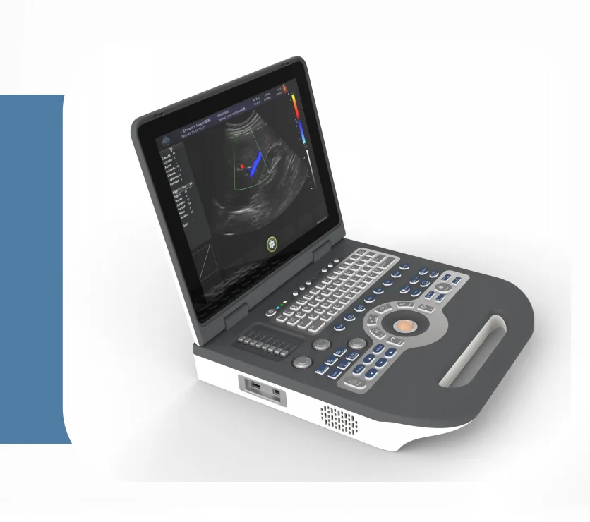 

Portable color ultrasound S3500 with abdominal convex array probe