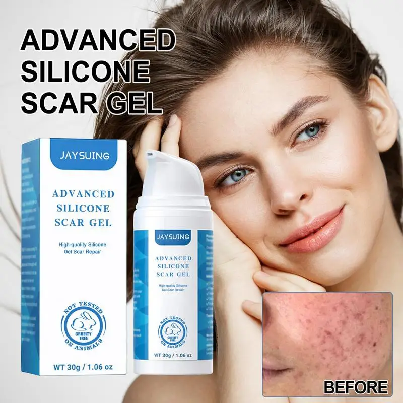 Рисунок 2 - Избавление от шрамов от растяжек