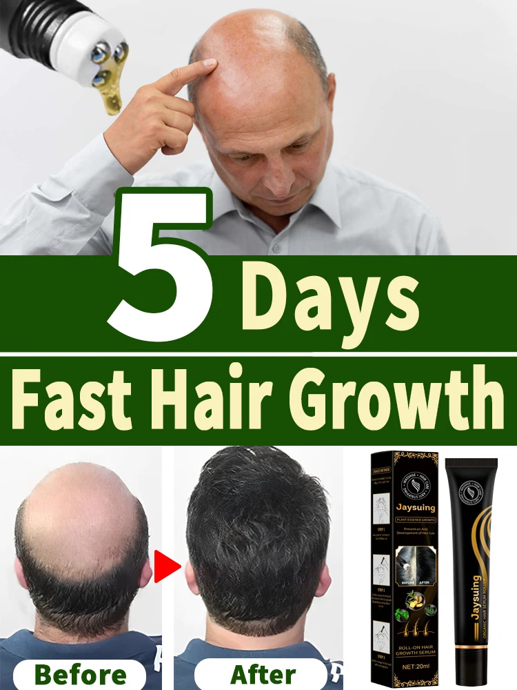 

Масло для роста волос для мужчин Biotin быстрое лечение облысения Сыворотка для утолщения волос очень мощный органический имбирь Прямая поставка продукт toSell