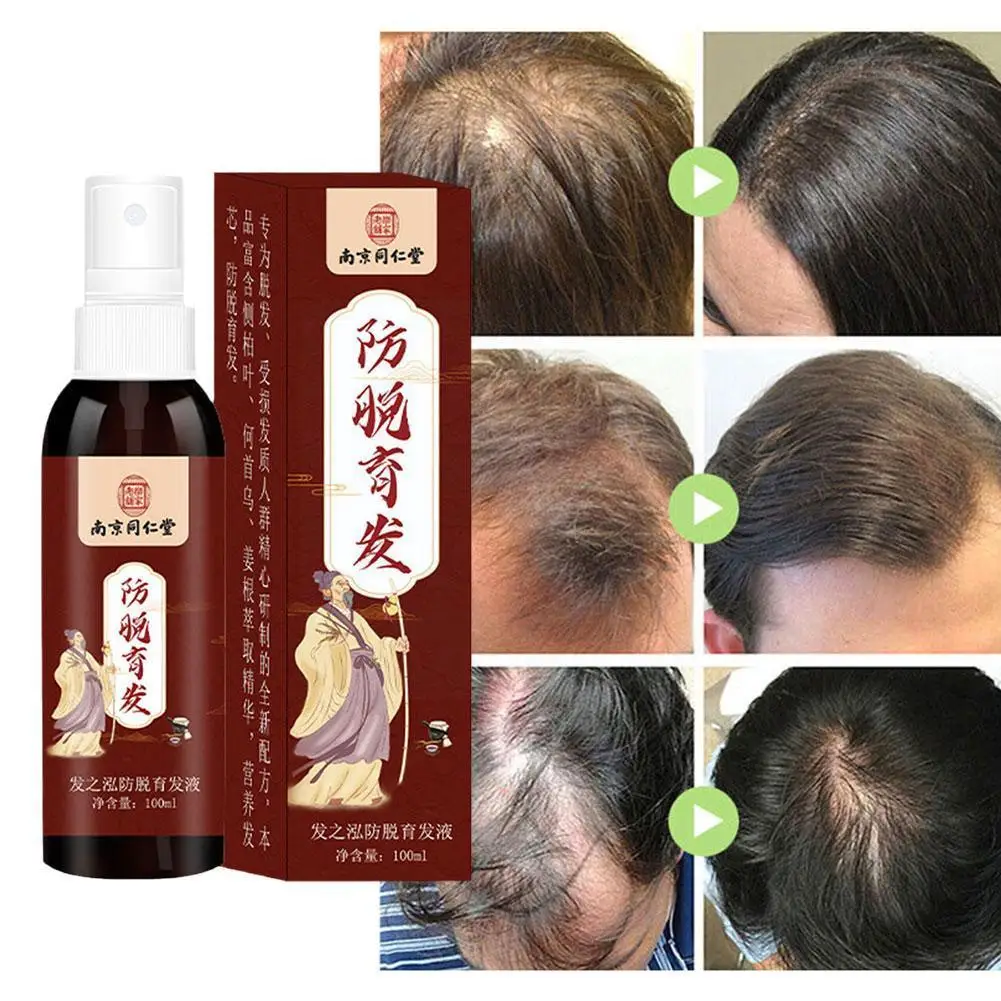 

Уход за волосами и кожей головы эссенция спрей для быстрого роста волос уход за волосами Лечение выпадения масла для кожи головы Эфирное Предотвращение волос W9n0