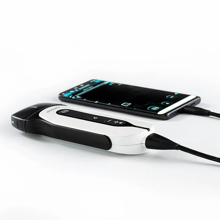 

Chison SonoEye Portable Handheld Ultrasound Device Palm Portable Ultrasound Scanner Machine Medical Ultrasound Instruments Price