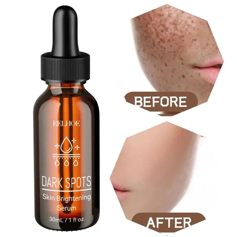 

Brightening Serums For Dark Spots 30ml Anti Spot Face Serums Pigment Correcting Essence Face White Serums Face Bright Essence