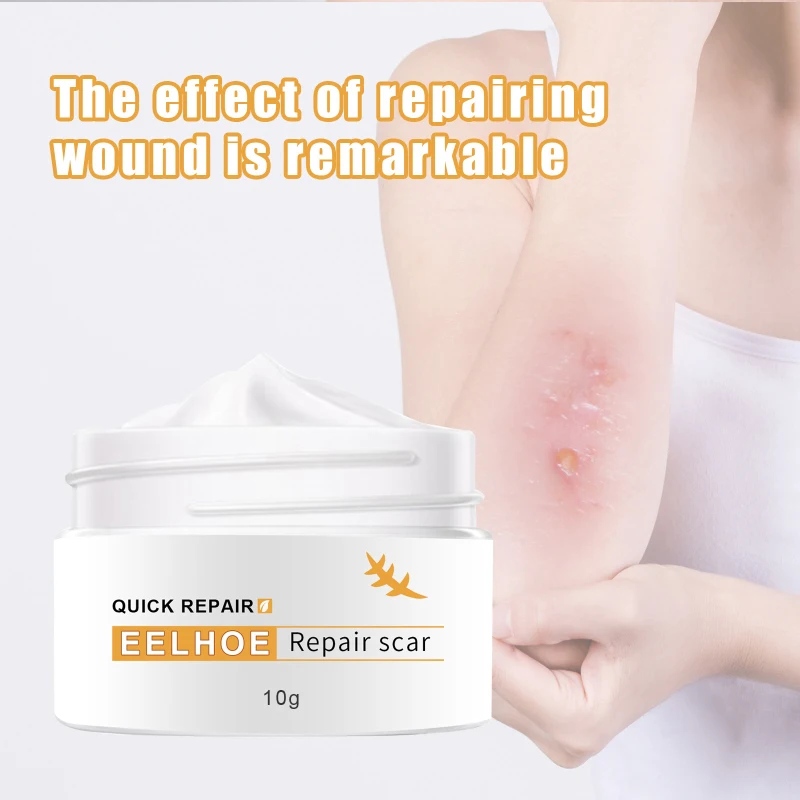 

Repair Scar Cream Skin Care Body Cream Stretch Mark Repair Cream Scar Removal Scars Line Wound Creams Body Skin Care
