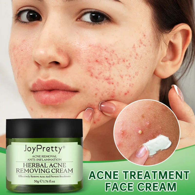 

2023 New Acne Face Cream Herbal Pimple Scar Removal Shrink Pore Oil Control Moisturizing Facial Cream Acne Treatment Skin Care