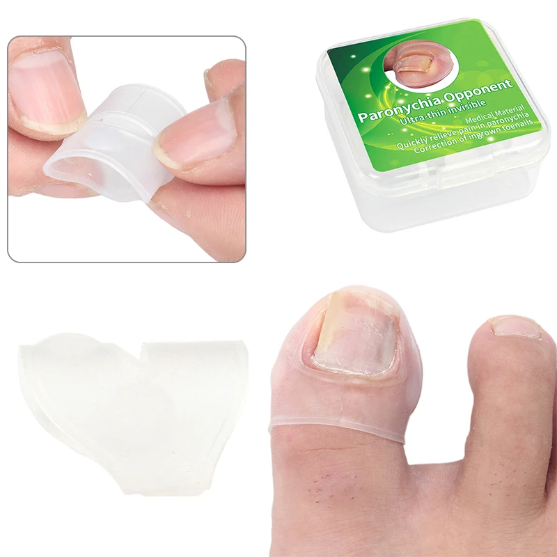 

1 пара (2 шт.) силиконовый инструмент для коррекции вросших ногтей Невидимый инструмент для лечения вросших ногтей эластичный зажим для выпрямления