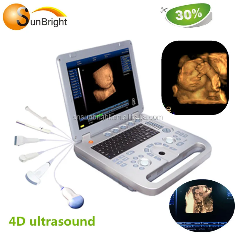 

Laptop ultrasound 4D echo machine on sale with factory price