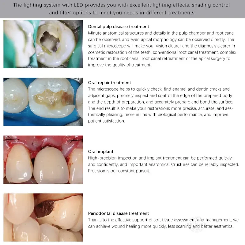 SCM600 Ultimate Медицинский хирургический операционный микроскоп с камерой