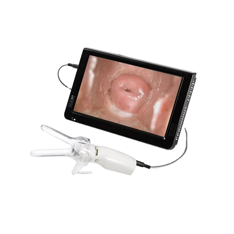 

Производители Colposcope, фотоаппараты Colposcopy Full HD для фотографий