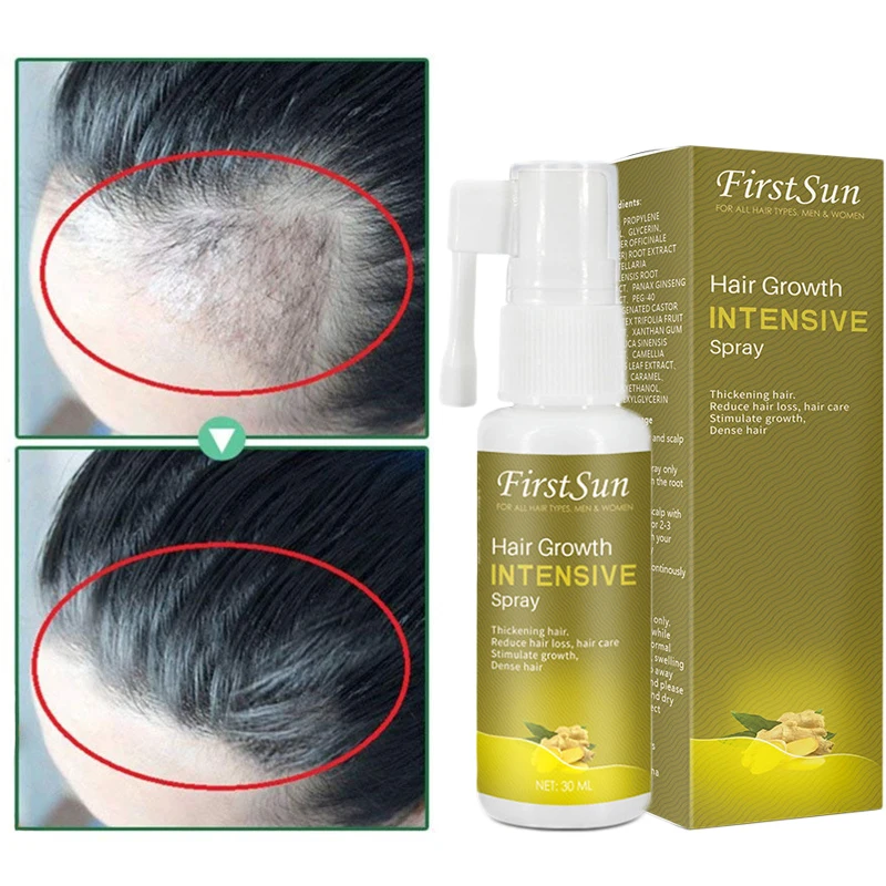 

Men Women Hair Growth Spray Ginger Fast Growing Products Hair Essential Oil Prevent Hair Loss Oily Scalp Treatment Care 30ML