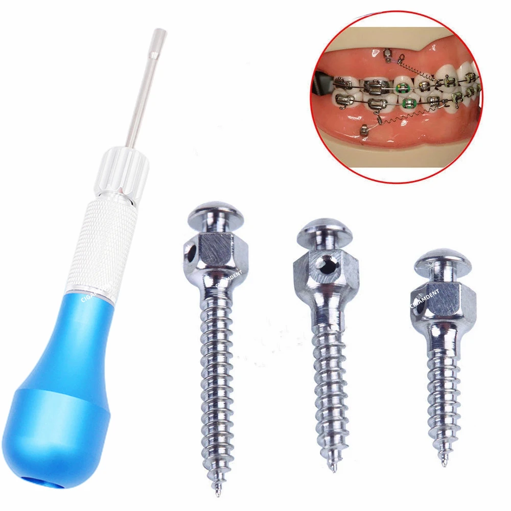 

Dental Orthodontic Mini Implant Micro Titanium Screw Self Drilling Tool Dentistry Anchor Nail Handle Driver Screwdriver