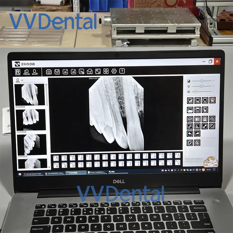 Odonto sem Galantia Датчик усовершенствования USB-соединение Компьютерная система