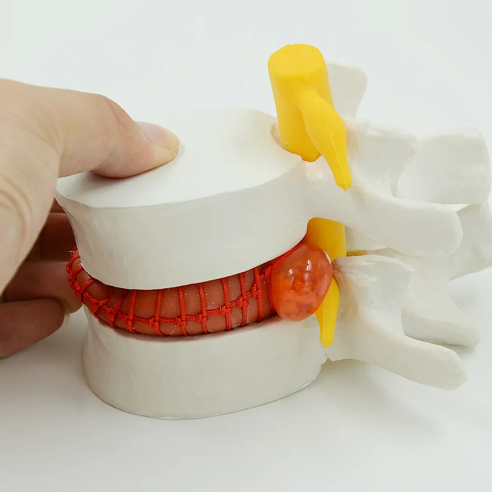 Анатомическая модель для хиропрактора межпозвонковых дисков модели поясничных