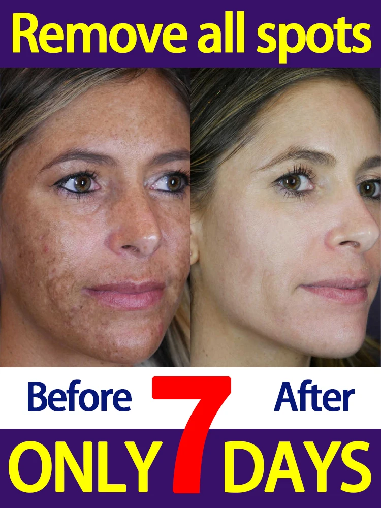 решает проблемы темного пятна