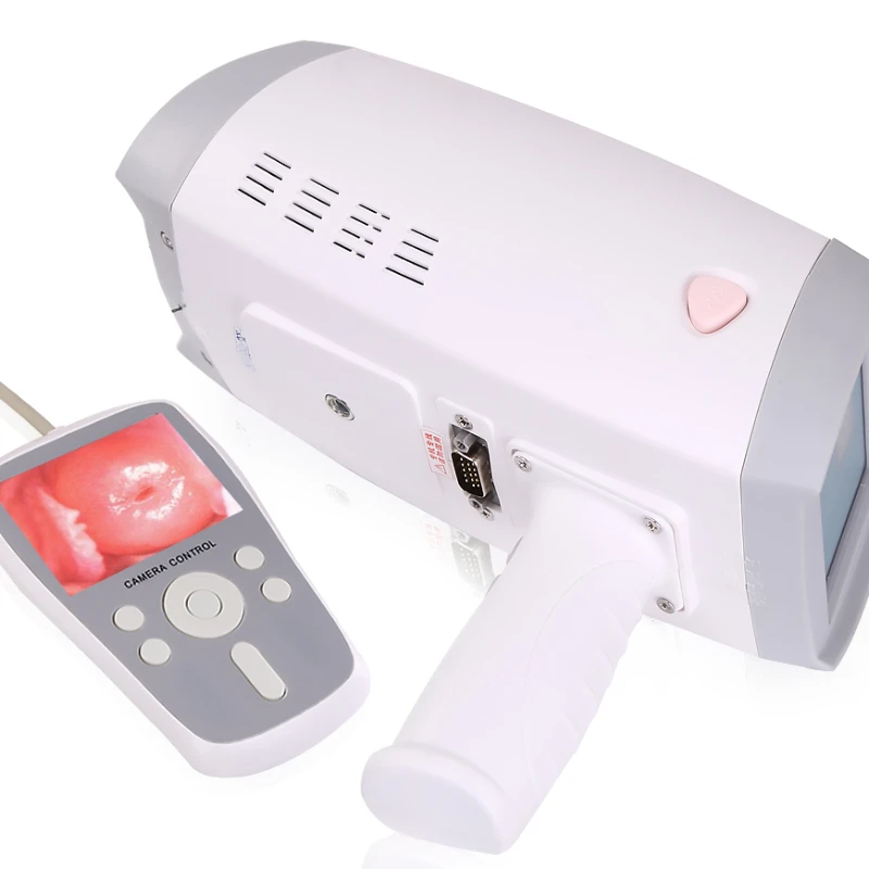 MY-F005 портативная Гинекологическая система Colposcopy цифровое электронное видео для