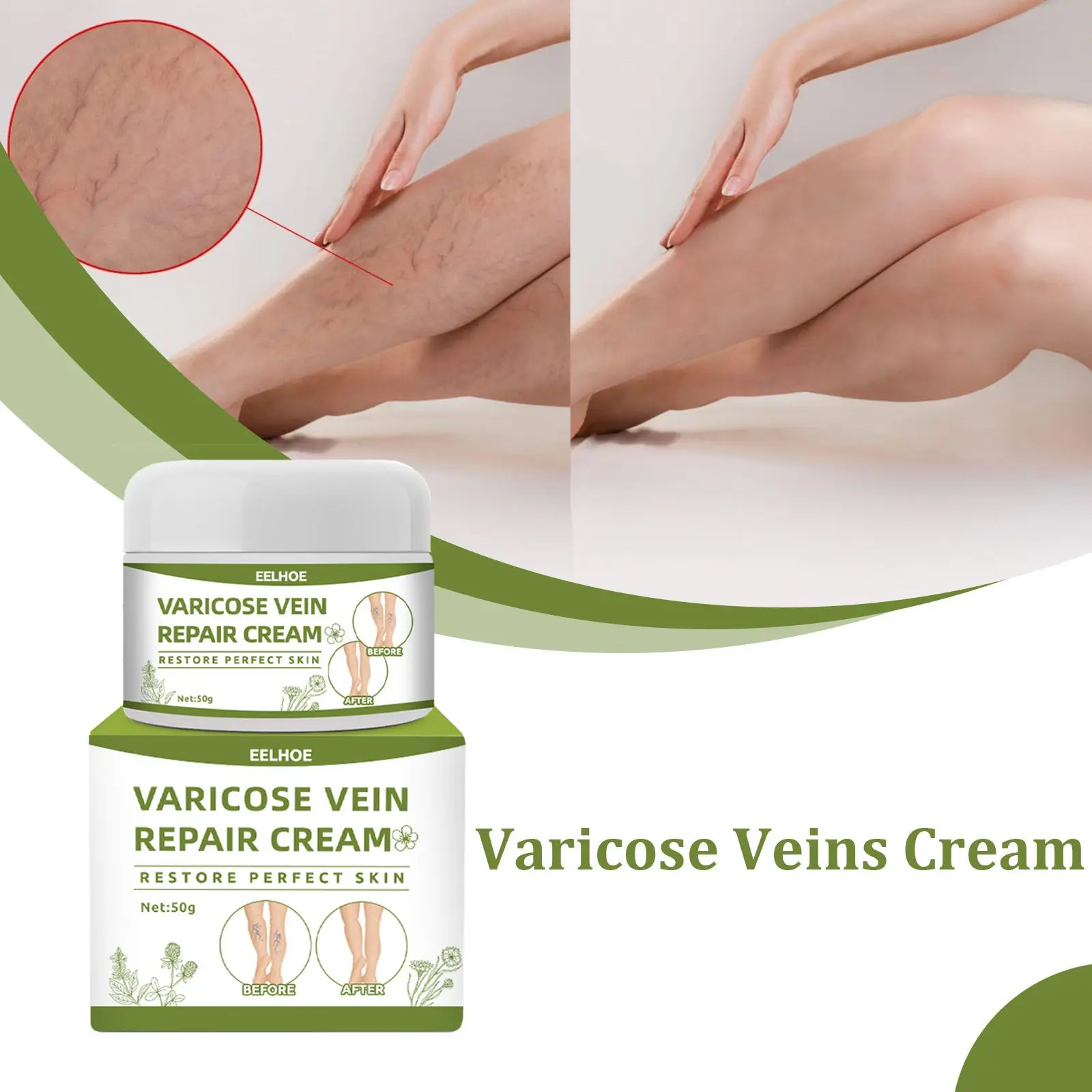 

Phlebitis Angiitis Effective Legs Varicose Veins Cream Vein Care Fading Cream Herbal Ointment Vasculitis Treatment