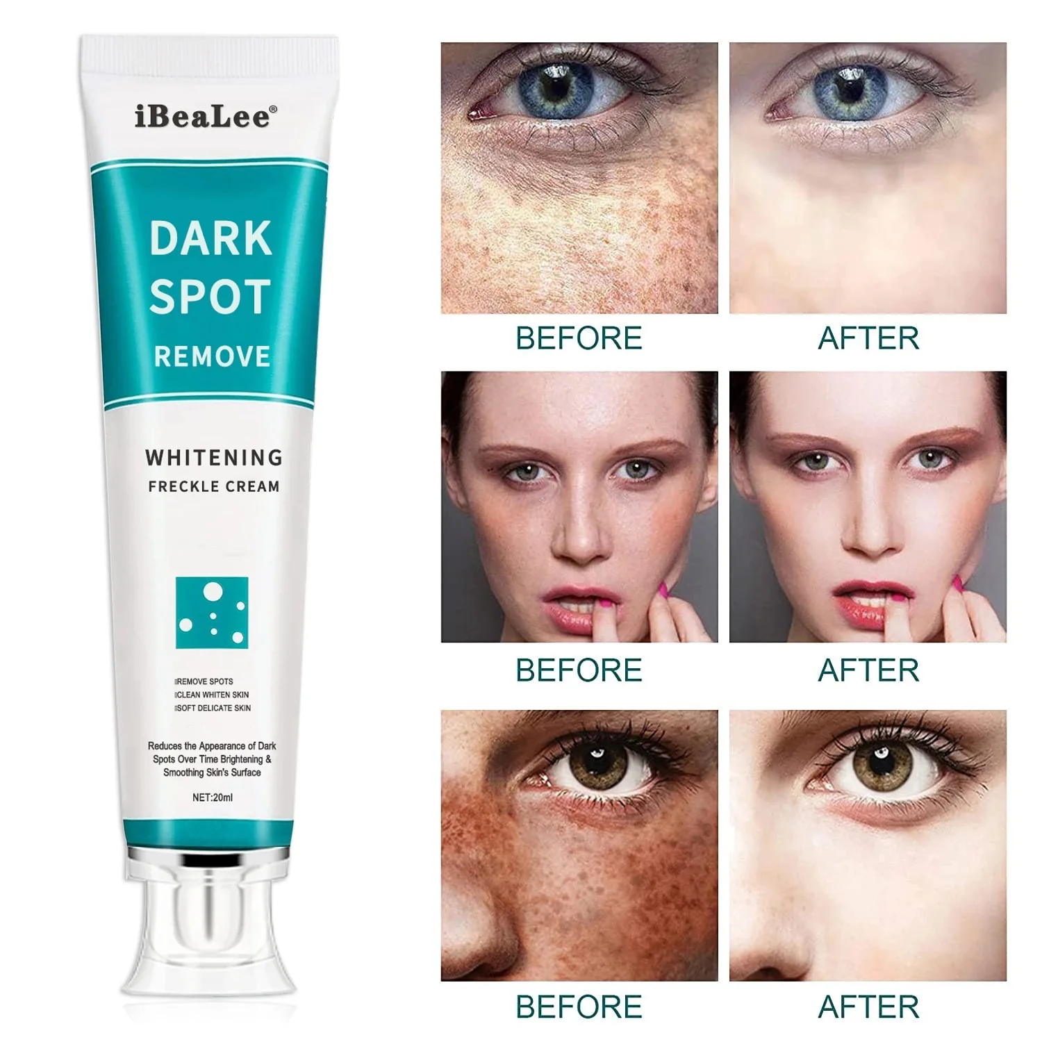 

Body Whitening Cream Moisturizing Skin Knee Whitening Remove Melanin Brighten Skin for Women Skin Care