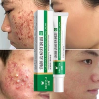 effective acne removal cream treatment acne scar spots cream control shrink pores whitening moisturizing anti acne face gel care